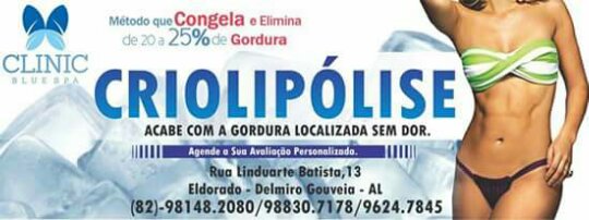 Conheça a criolipólise nova forma de remover gorduras localizadas, agora em Delmiro Gouveia